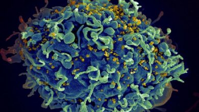 elektron - Wilayah.com.my Color-enhanced electron micrograph of a spherical immune cell with numerous surface projections and small yellow particles on its exterior.