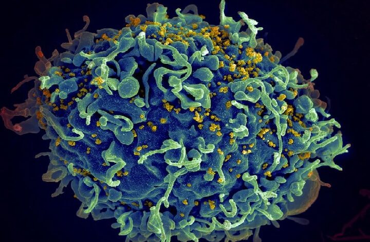 elektron - Wilayah.com.my Color-enhanced electron micrograph of a spherical immune cell with numerous surface projections and small yellow particles on its exterior.